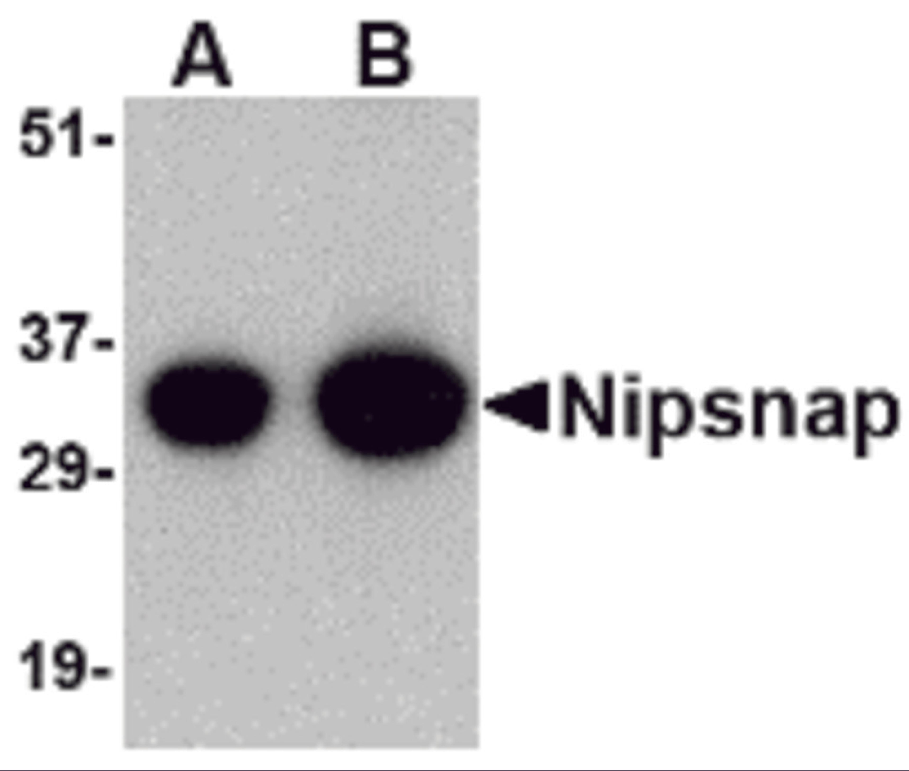 Western blot analysis of NIPSNAP in human brain tissue lysate with NIPSNAP antibody at (A) 0.5 and (B) 1 μg/mL.