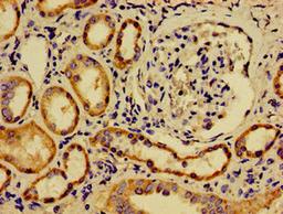Immunohistochemistry of paraffin-embedded human kidney tissue using CSB-PA666241LA01HU at dilution of 1:100