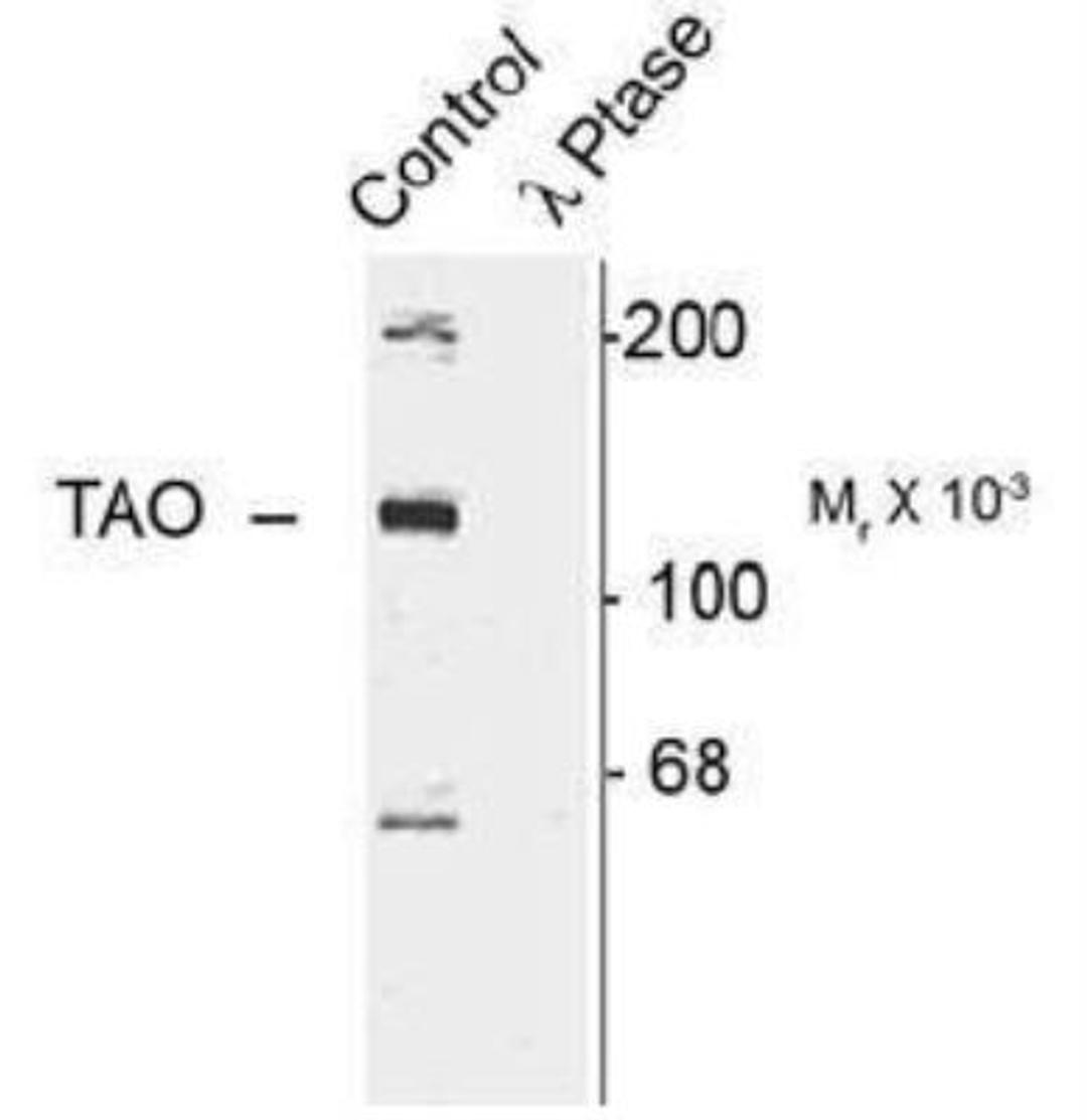 Western Blot: TAO2 [p Ser181] Antibody [NB300-233] - Western blot of rat cortex lysate showing specific immunolabeling of the ~120k TAO2 phosphorylated at Ser181 (Control). The phosphospecificity of this labeling is shown in the second lane (lambda-phosphatase). The blot is identical to the control except that it was incubatede (1200 units for 30 min) before being exposed to the Ser181 TAO2 antibody. The immunolabeling is completely eliminated by treatment with lambda-phosphatase.