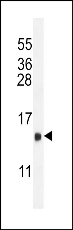 Western blot analysis in mouse heart tissue lysates (35ug/lane).