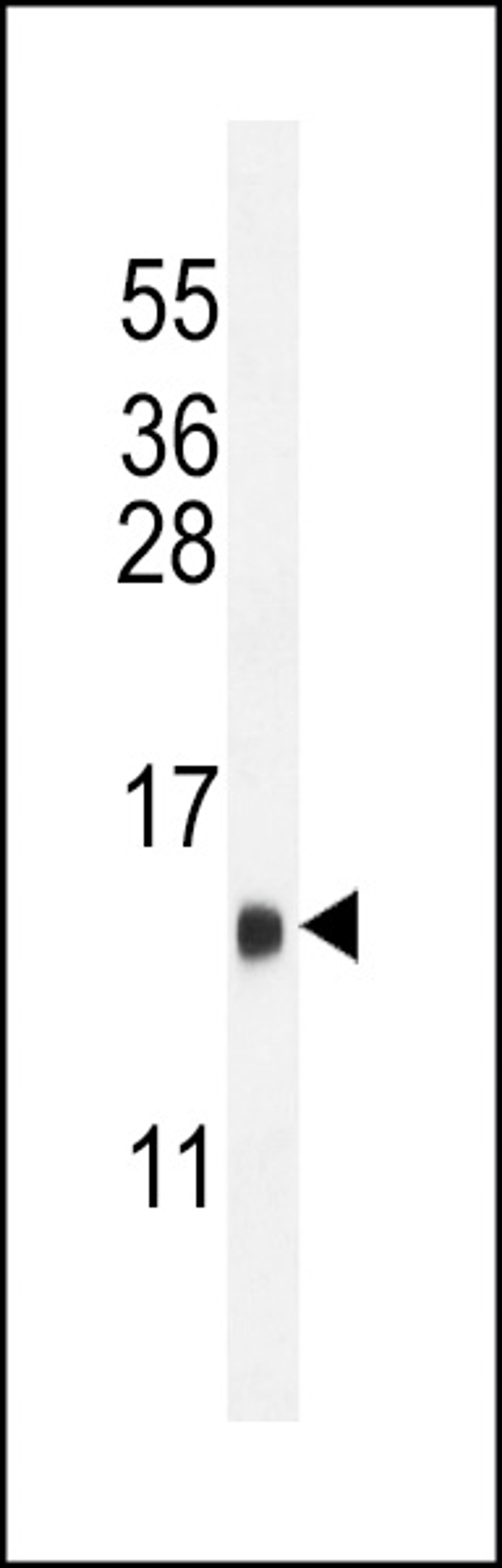 Western blot analysis in mouse heart tissue lysates (35ug/lane).