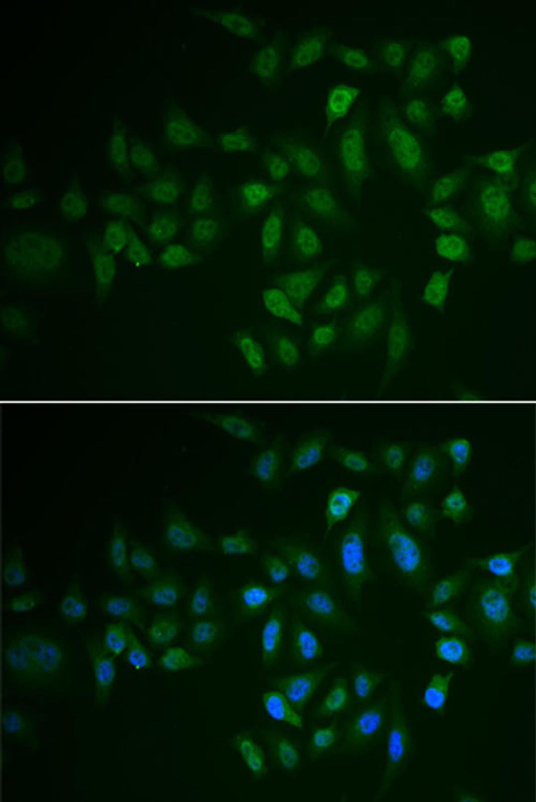 Immunofluorescence - MYLK3 antibody (A6663)