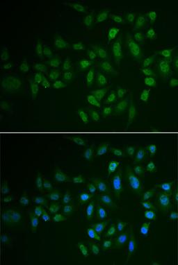 Immunofluorescence - MYLK3 antibody (A6663)