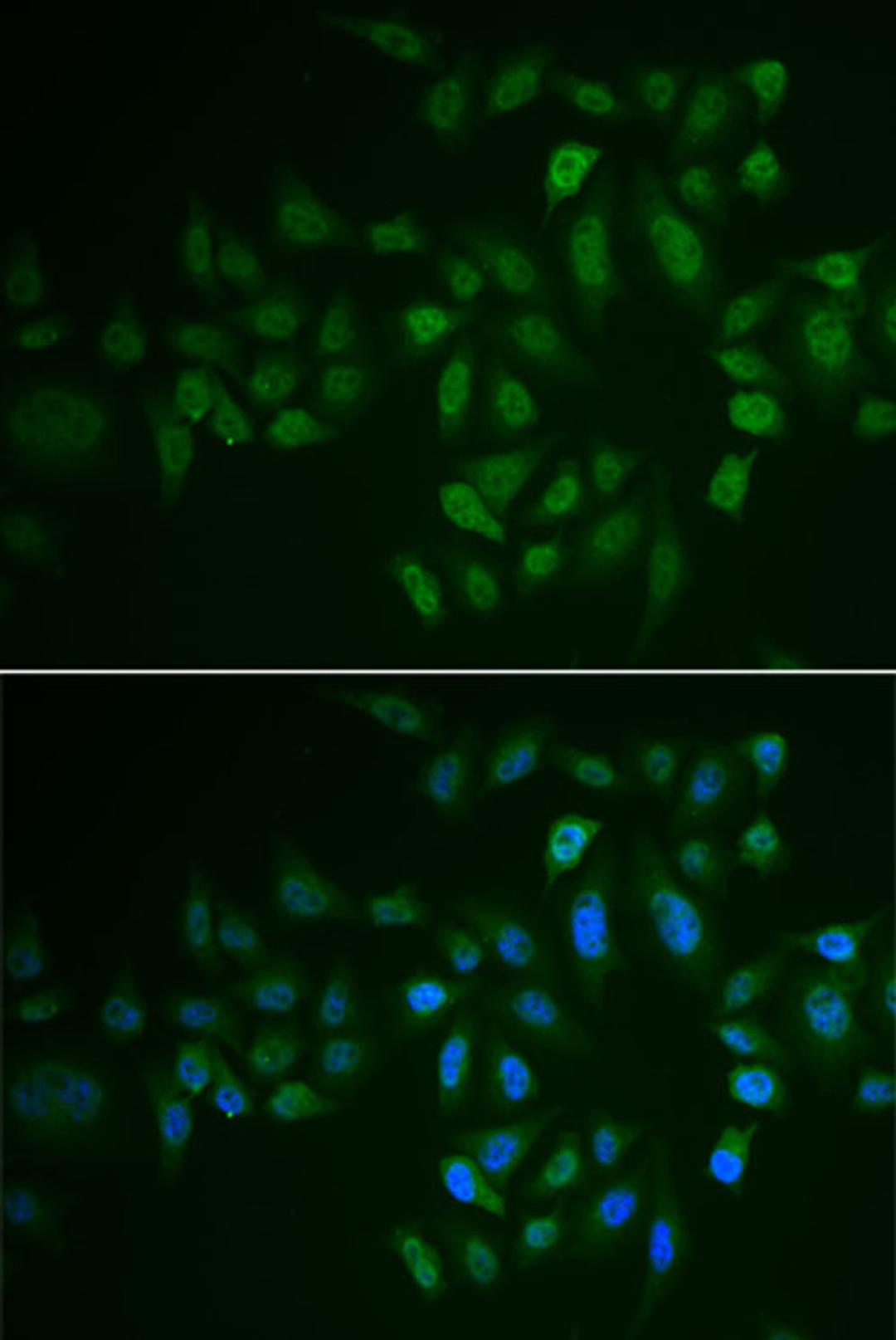 Immunofluorescence - MYLK3 antibody (A6663)