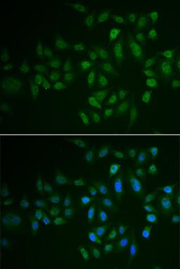 Immunofluorescence - MYLK3 antibody (A6663)