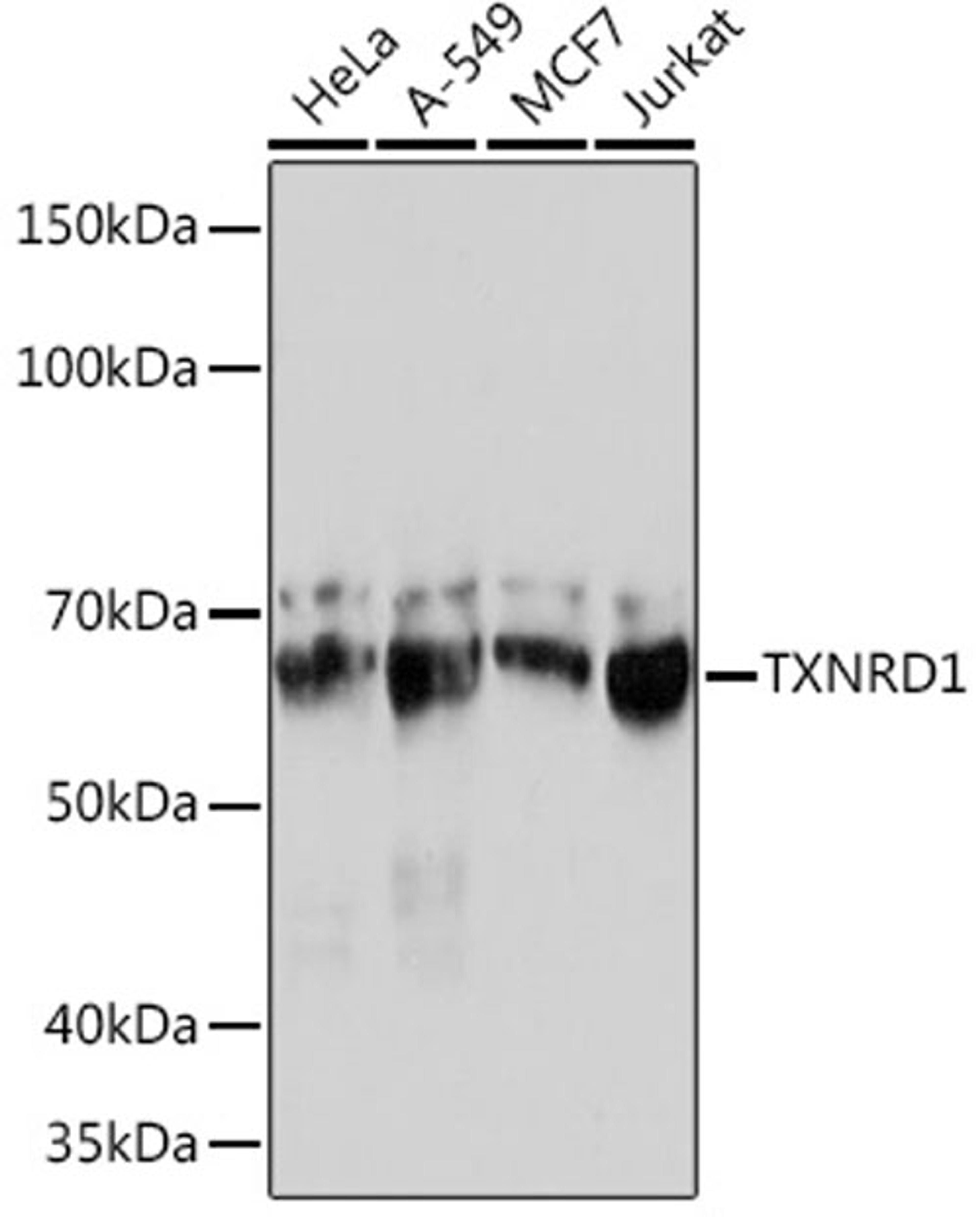 Western blot - TXNRD1 Rabbit mAb (A4725)