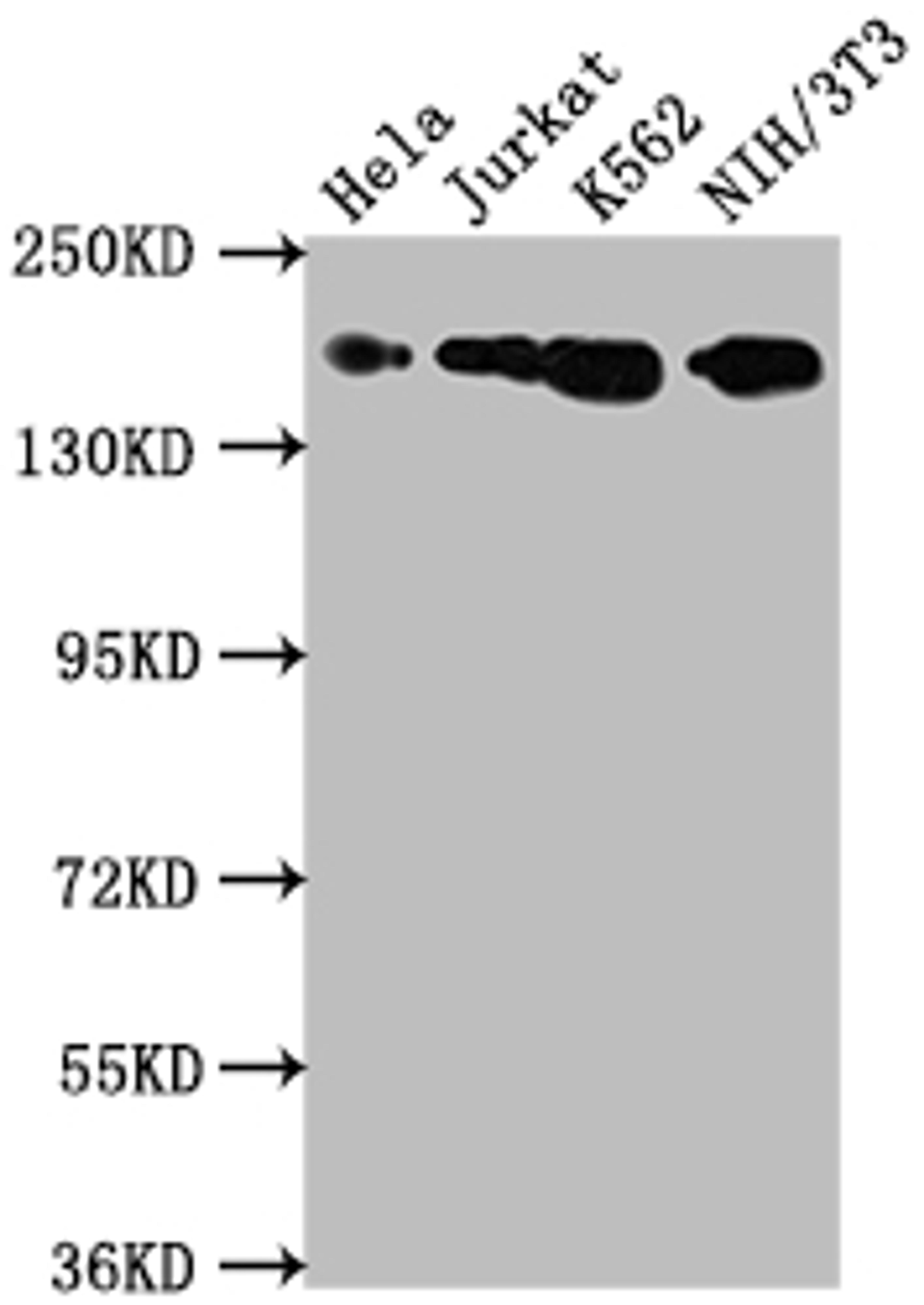 Western Blot. Positive WB detected in: Hela whole cell lysate, Jurkat whole cell lysate, K562 whole cell lysate, NIH/3T3 whole cell lysate. All lanes: TOP2A antibody at 1:1500. Secondary. Goat polyclonal to rabbit IgG at 1/50000 dilution. Predicted band size: 175, 178, 179, 183 kDa. Observed band size: 175 kDa. 