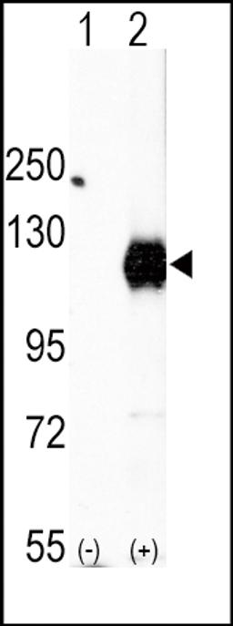 Western blot analysis of EphA2 using rabbit polyclonal EphA2 Antibody.293 cell lysates (2 ug/lane) either nontransfected (Lane 1) or transiently transfected with the EphA2 gene (Lane 2).