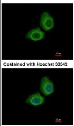 Immunocytochemistry/Immunofluorescence: UBE2O Antibody [NBP2-20787] - Immunofluorescence analysis of methanol-fixed A431, using antibody at 1:500 dilution.