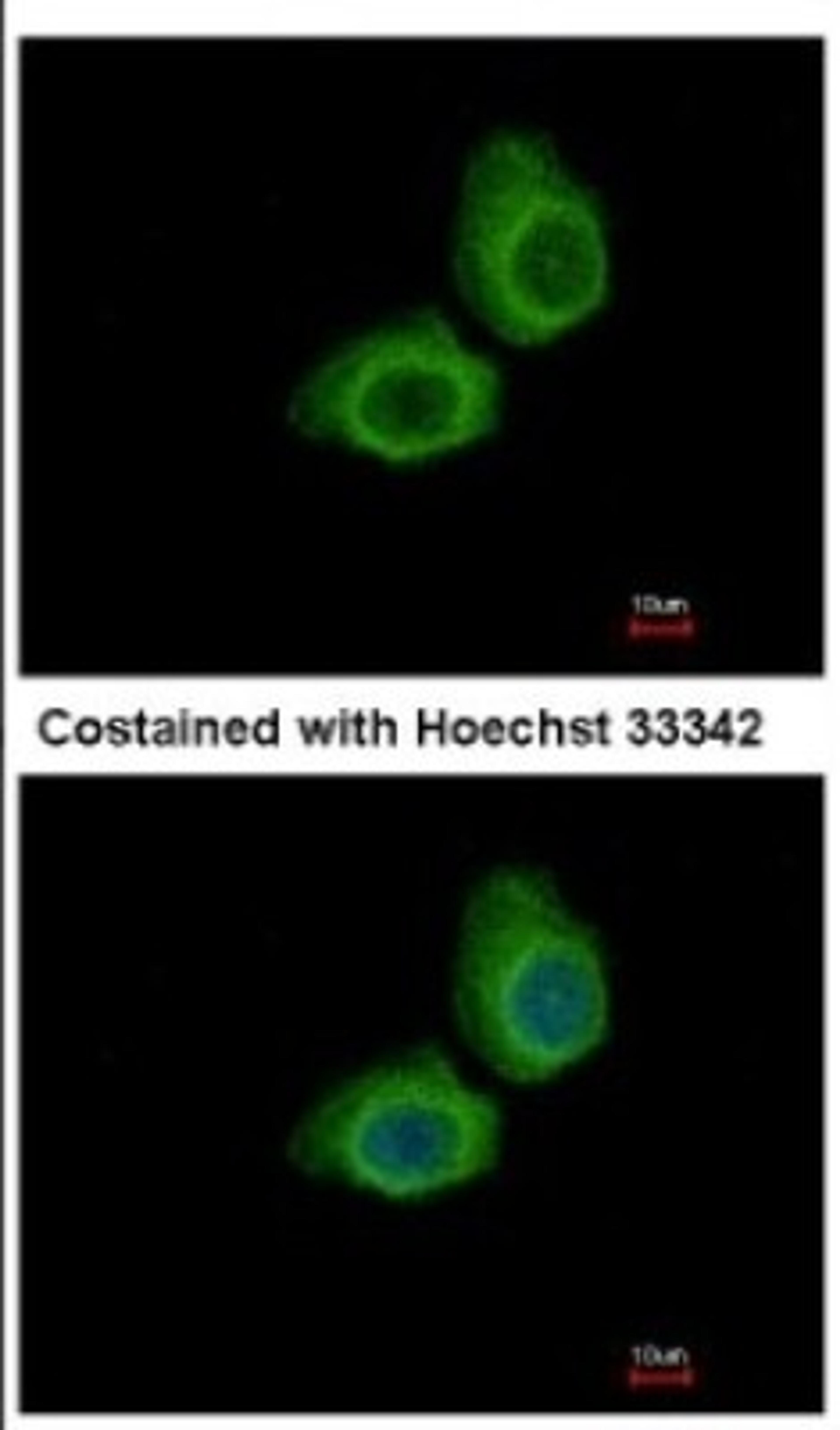 Immunocytochemistry/Immunofluorescence: UBE2O Antibody [NBP2-20787] - Immunofluorescence analysis of methanol-fixed A431, using antibody at 1:500 dilution.