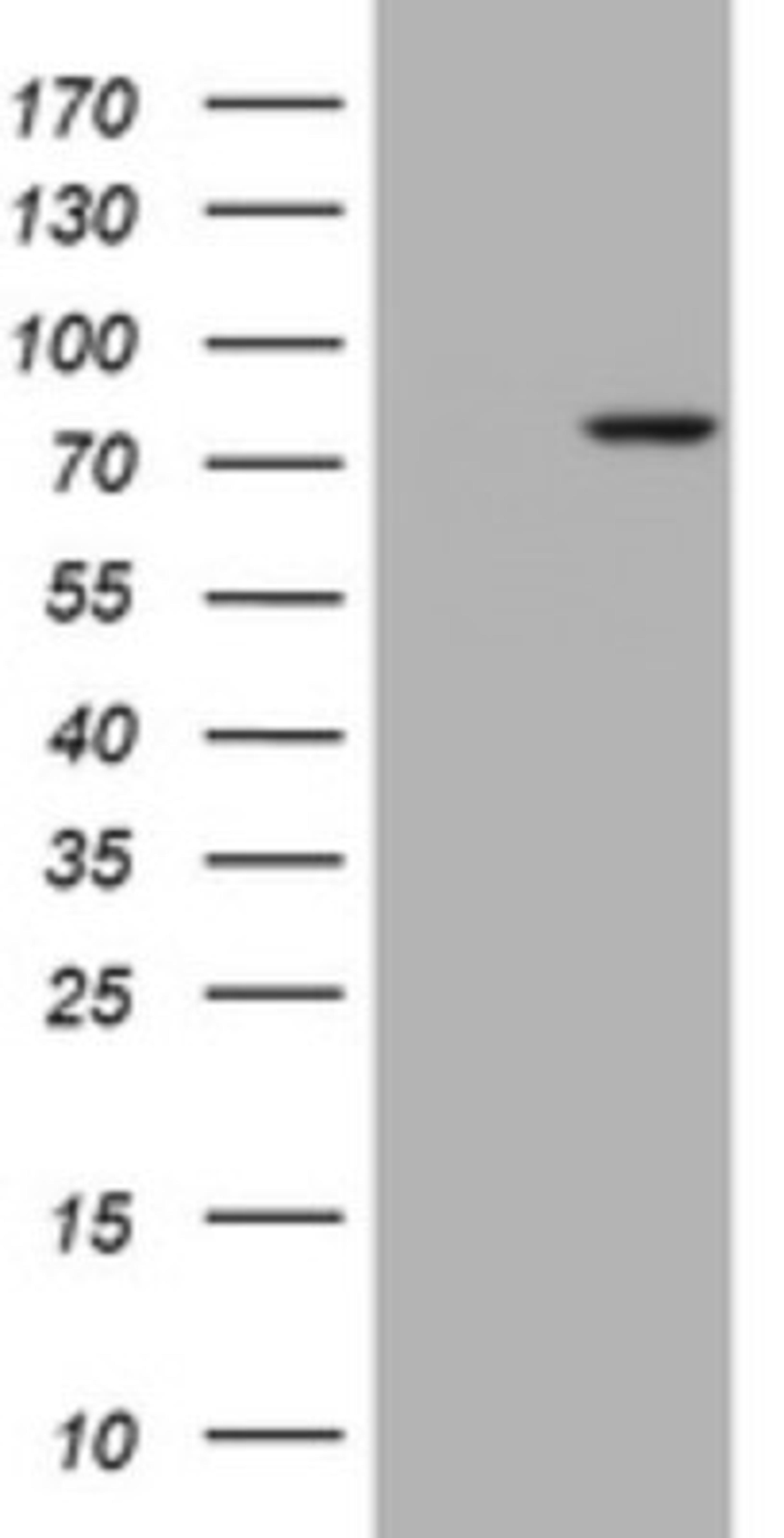 Western Blot: RASGRP3 Antibody (2C11) [NBP2-45528] - Analysis of HEK293T cells were transfected with the pCMV6-ENTRY control (Left lane) or pCMV6-ENTRY RASGRP3 .