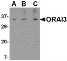 Western blot analysis of ORAI3 in A20 cell lysate with ORAI3 antibody at (A) 1, (B) 2 and (C) 4 μg/mL.