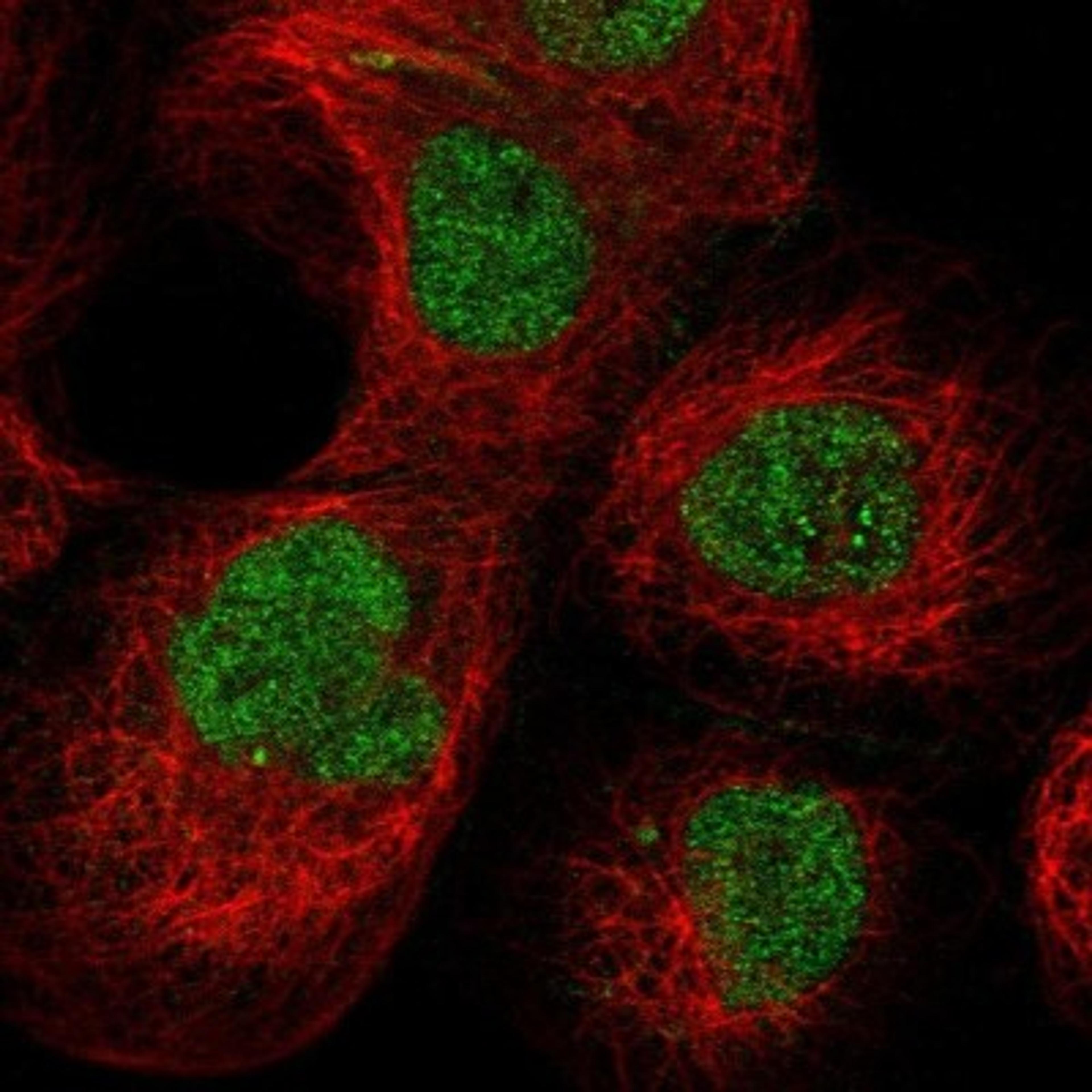 Immunocytochemistry/Immunofluorescence: PCYT1A Antibody [NBP1-84366] - Staining of human cell line A-431 shows positivity in nucleus but not nucleoli.