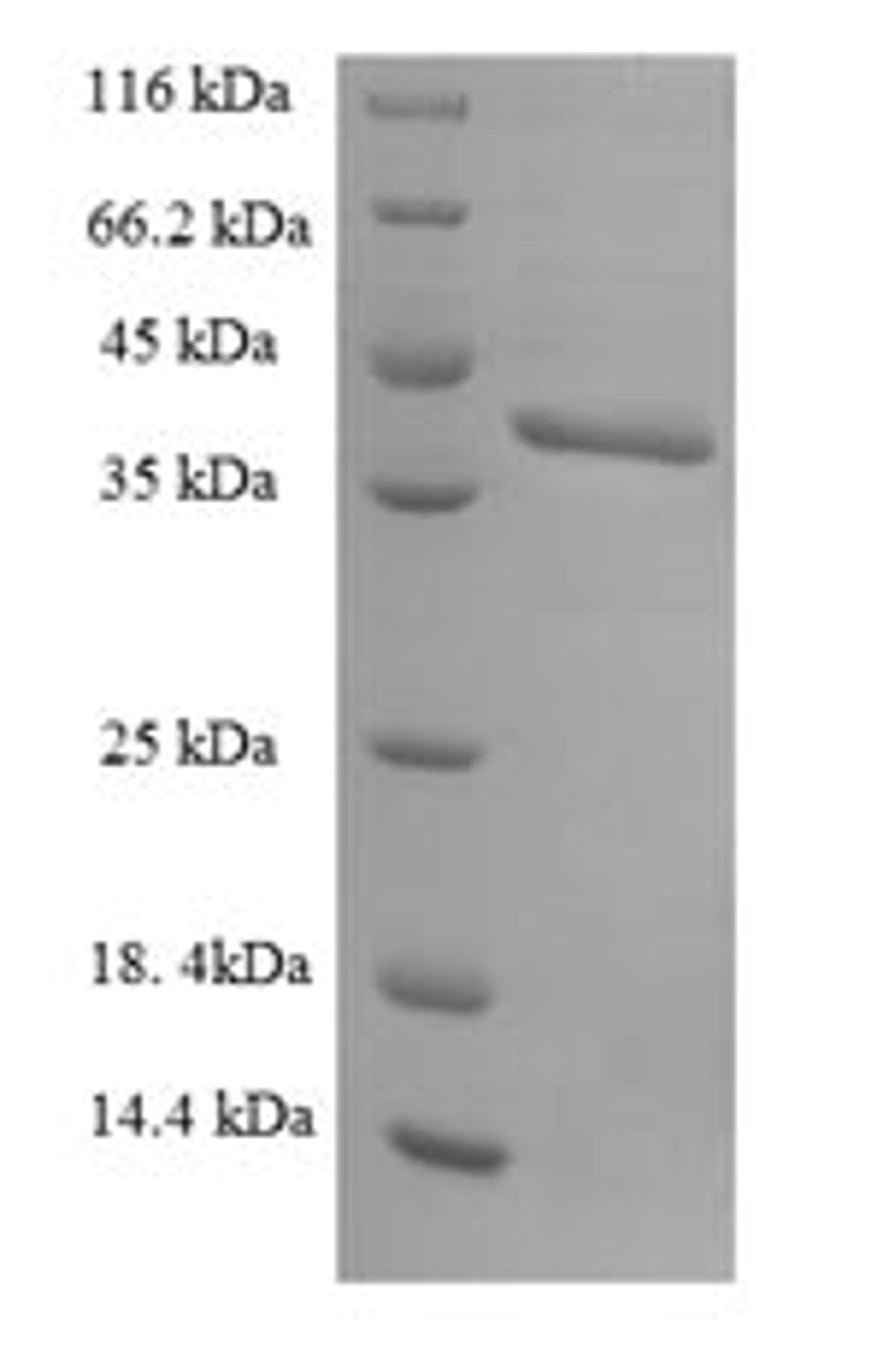 (Tris-Glycine gel) Discontinuous SDS-PAGE (reduced) with 5% enrichment gel and 15% separation gel.