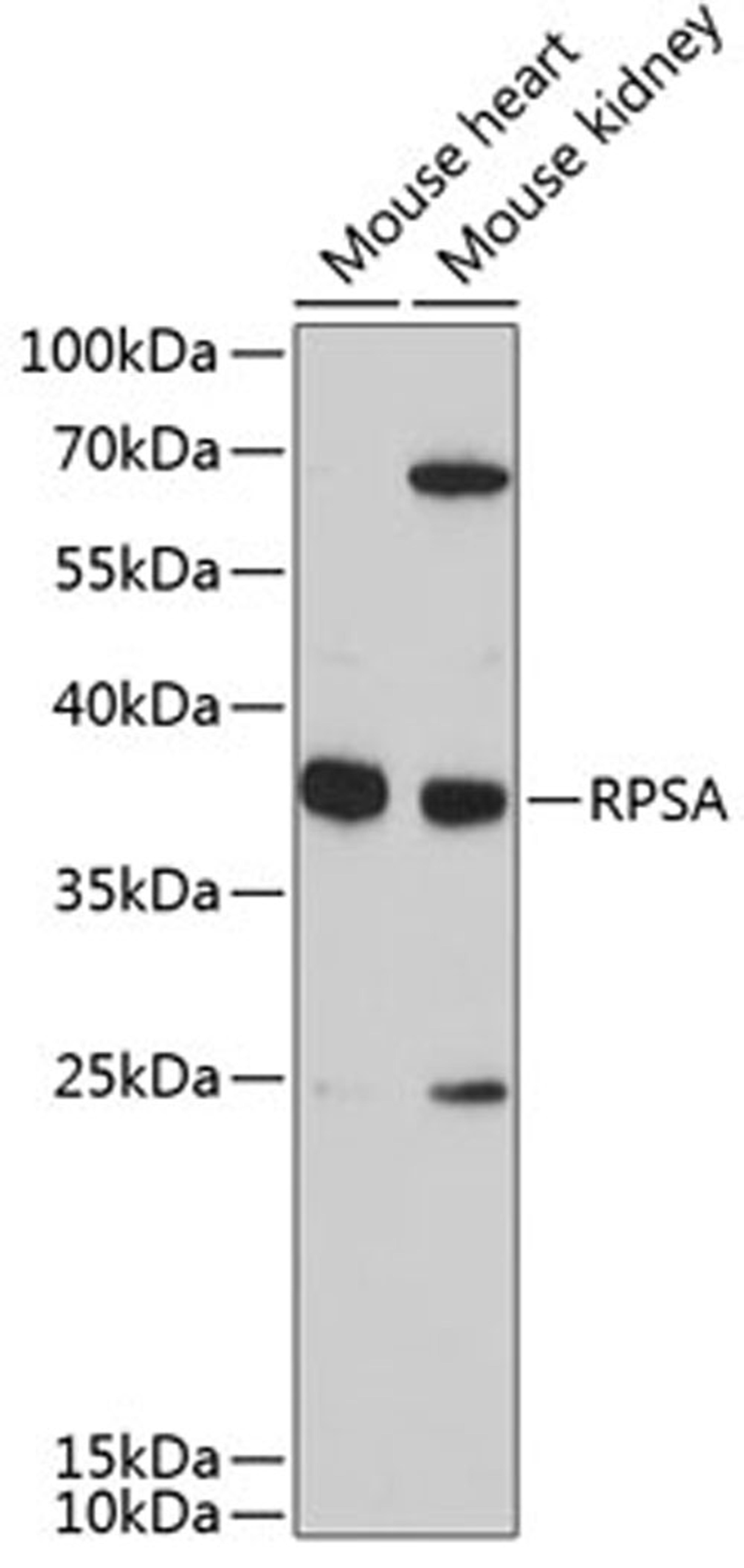 Western blot - RPSA antibody (A9008)