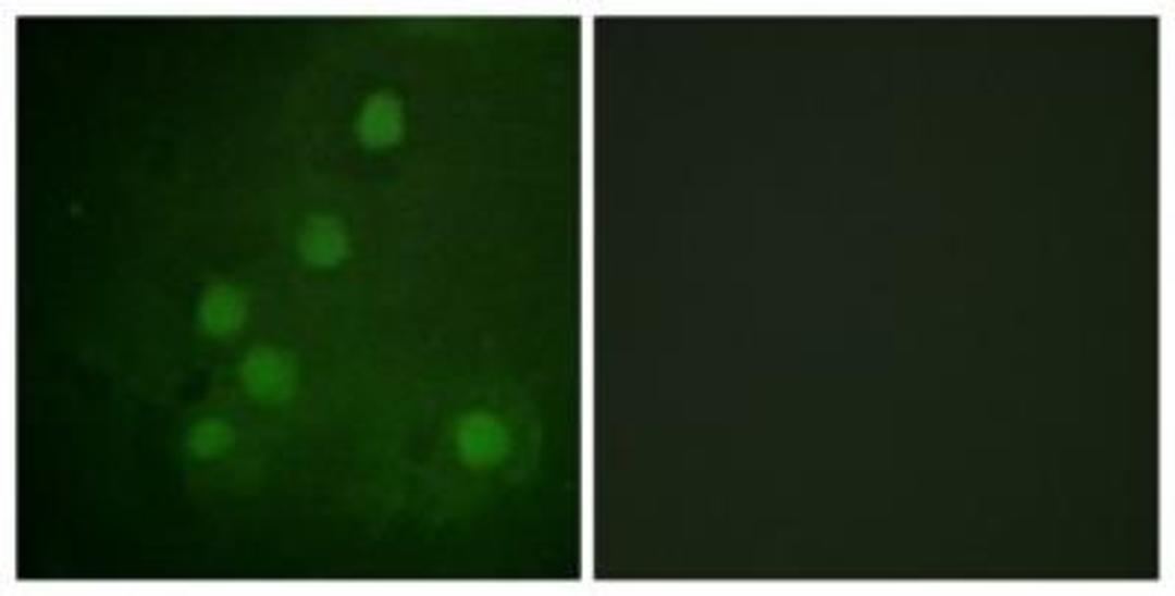 Immunocytochemistry: RAD52 Antibody [NBP1-61726] - Analysis of COS7 cells, using RAD52  Antibody. The picture on the right is treated with the synthesized peptide.