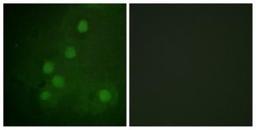 Immunocytochemistry: RAD52 Antibody [NBP1-61726] - Analysis of COS7 cells, using RAD52  Antibody. The picture on the right is treated with the synthesized peptide.