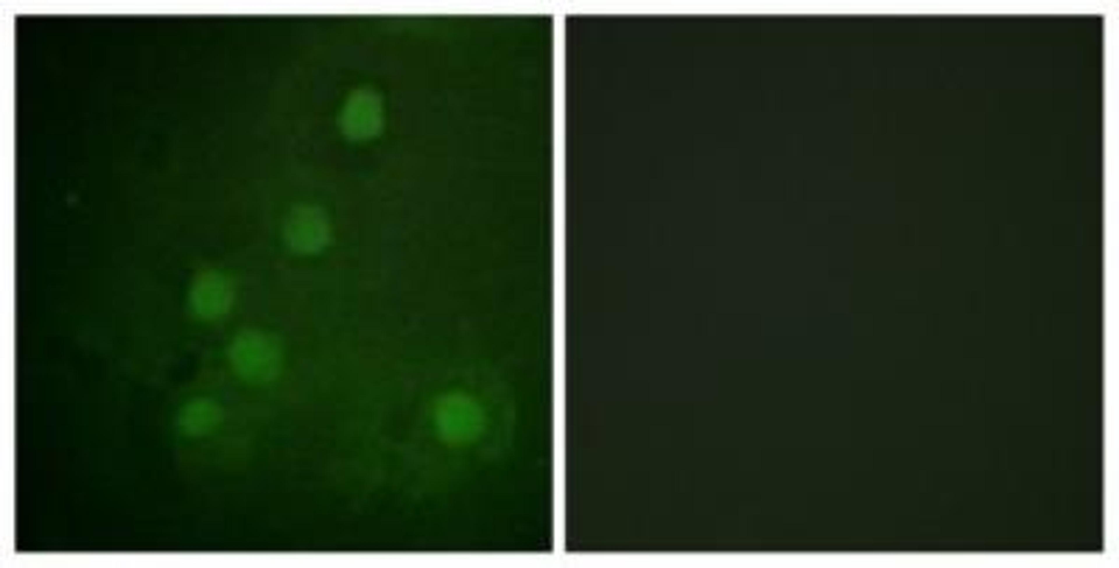 Immunocytochemistry: RAD52 Antibody [NBP1-61726] - Analysis of COS7 cells, using RAD52  Antibody. The picture on the right is treated with the synthesized peptide.