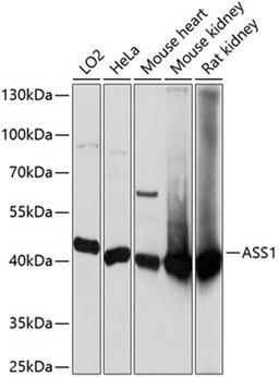 Western blot - ASS1 antibody (A2012)