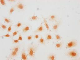 Immunocytochemistry analysis of CSB-PA010418PA36hibHU diluted at 1:15 and staining in Hela cells(treated with 30mM sodium butyrate for 4h) performed on a Leica BondTM system. The cells were fixed in 4% formaldehyde, permeabilized using 0.2% Triton X-100 and blocked with 10% normal goat serum 30min at RT. Then primary antibody (1% BSA) was incubated at 4°C overnight. The primary is detected by a biotinylated secondary antibody and visualized using an HRP conjugated SP system.