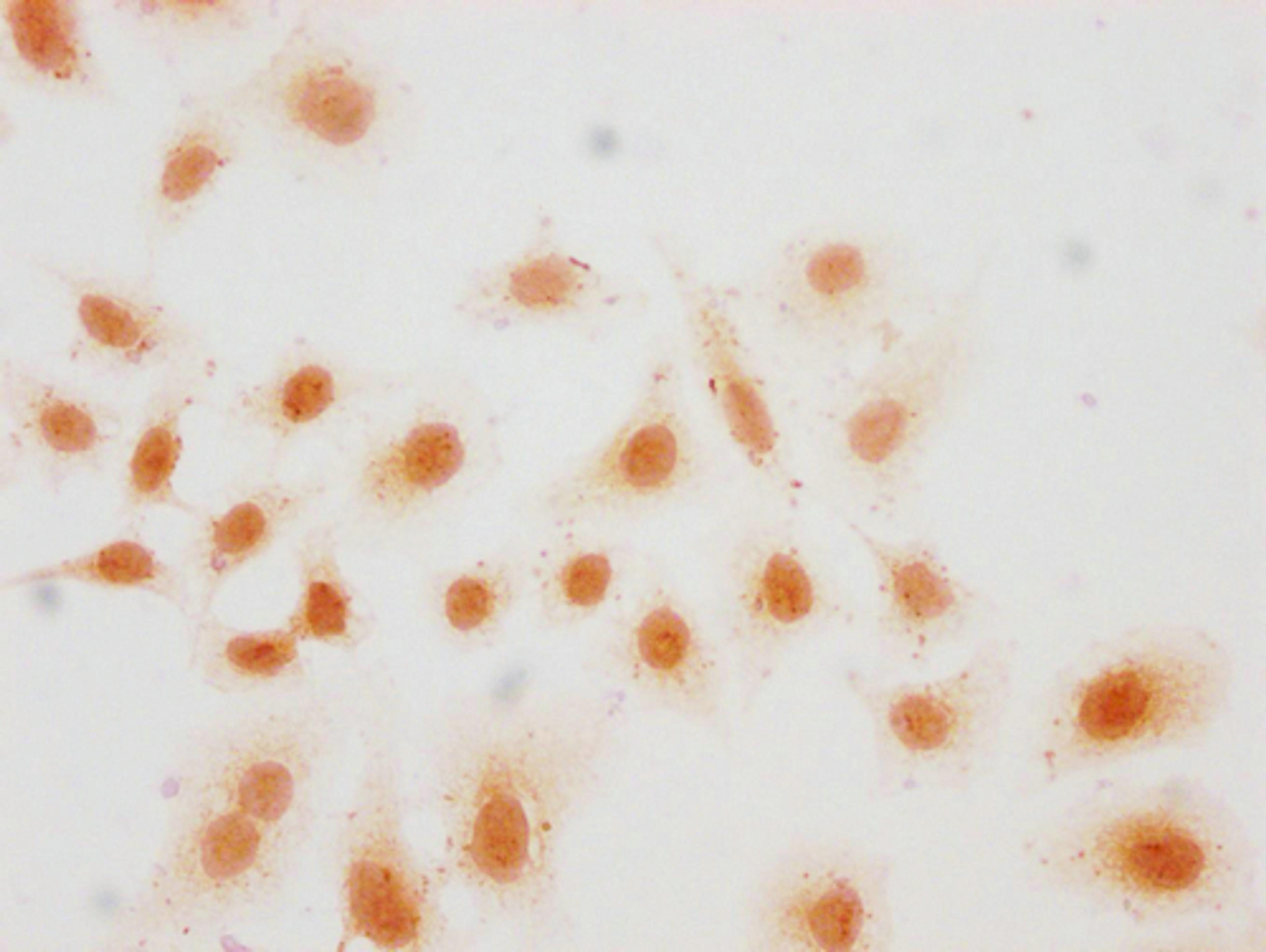Immunocytochemistry analysis of CSB-PA010418PA36hibHU diluted at 1:15 and staining in Hela cells(treated with 30mM sodium butyrate for 4h) performed on a Leica BondTM system. The cells were fixed in 4% formaldehyde, permeabilized using 0.2% Triton X-100 and blocked with 10% normal goat serum 30min at RT. Then primary antibody (1% BSA) was incubated at 4°C overnight. The primary is detected by a biotinylated secondary antibody and visualized using an HRP conjugated SP system.