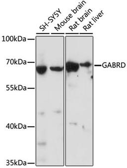 Western blot - GABRD antibody (A16016)