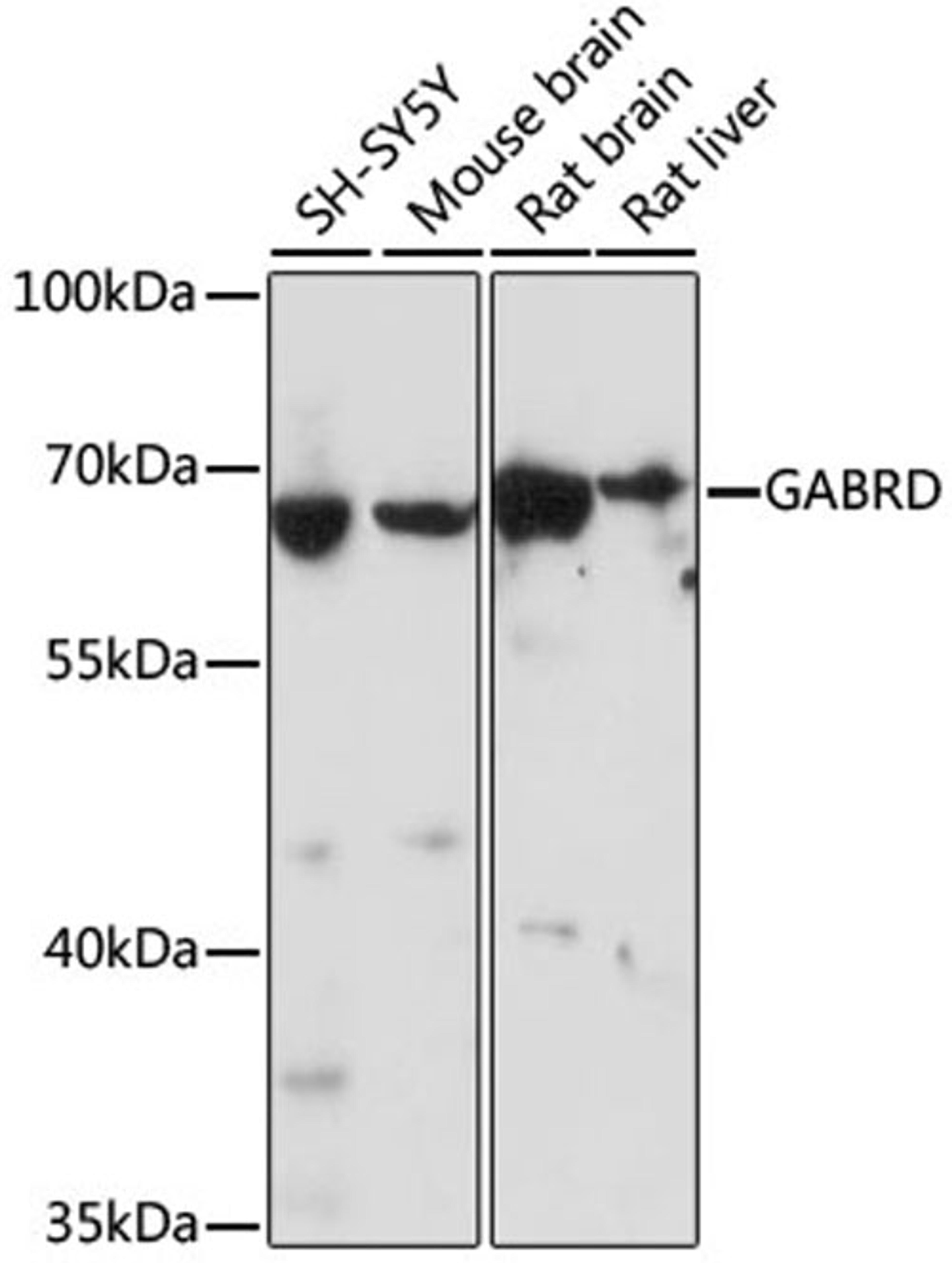 Western blot - GABRD antibody (A16016)