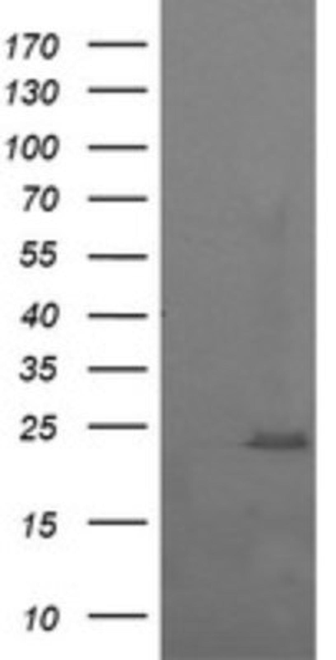 Western Blot: RAB37 Antibody (2F1) [NBP2-45926] - Analysis of HEK293T cells were transfected with the pCMV6-ENTRY control (Left lane) or pCMV6-ENTRY RAB37.