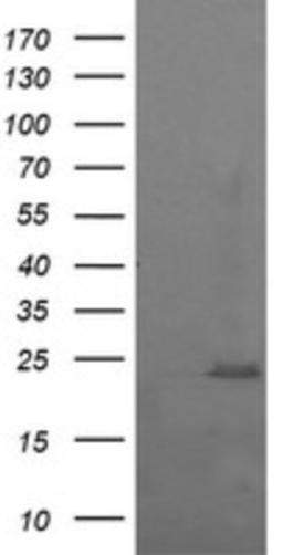 Western Blot: RAB37 Antibody (2F1) [NBP2-45926] - Analysis of HEK293T cells were transfected with the pCMV6-ENTRY control (Left lane) or pCMV6-ENTRY RAB37.