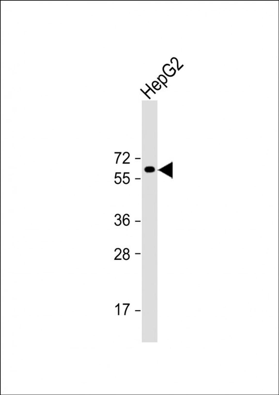 Western Blot at 1:2000 dilution + HepG2 whole cell lysate Lysates/proteins at 20 ug per lane.