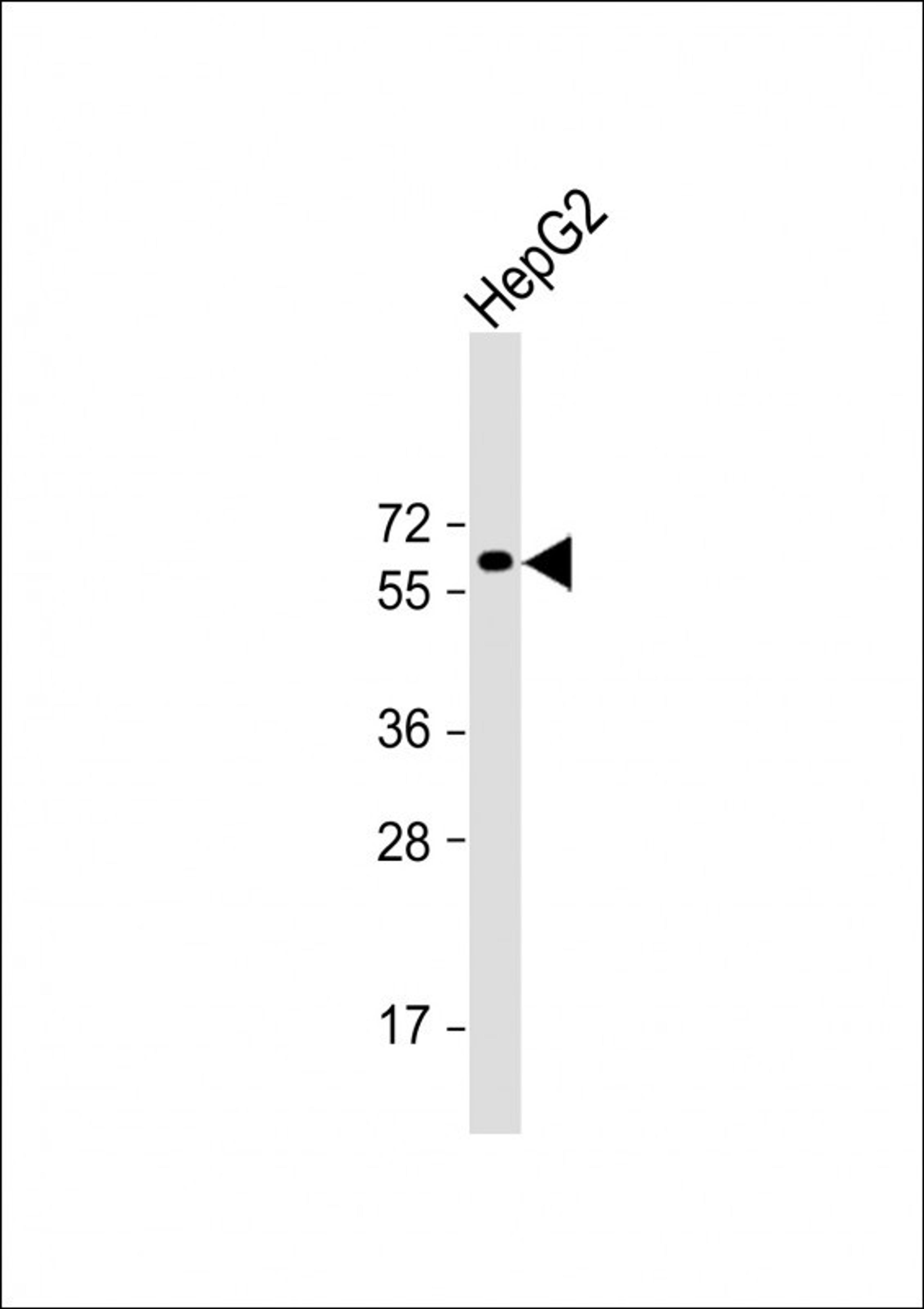 Western Blot at 1:2000 dilution + HepG2 whole cell lysate Lysates/proteins at 20 ug per lane.