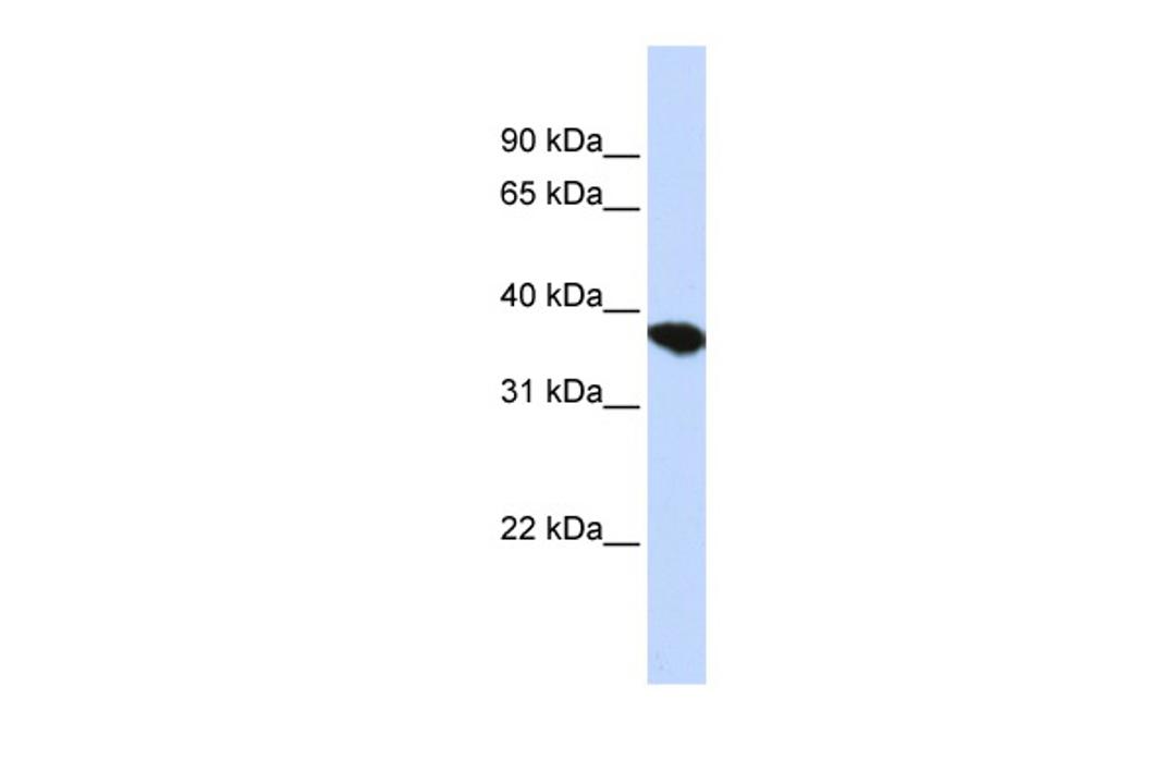 Antibody used in WB on Human HepG2 at 0.2-1 ug/ml.