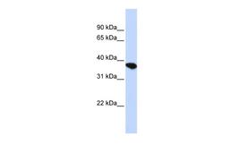 Antibody used in WB on Human HepG2 at 0.2-1 ug/ml.