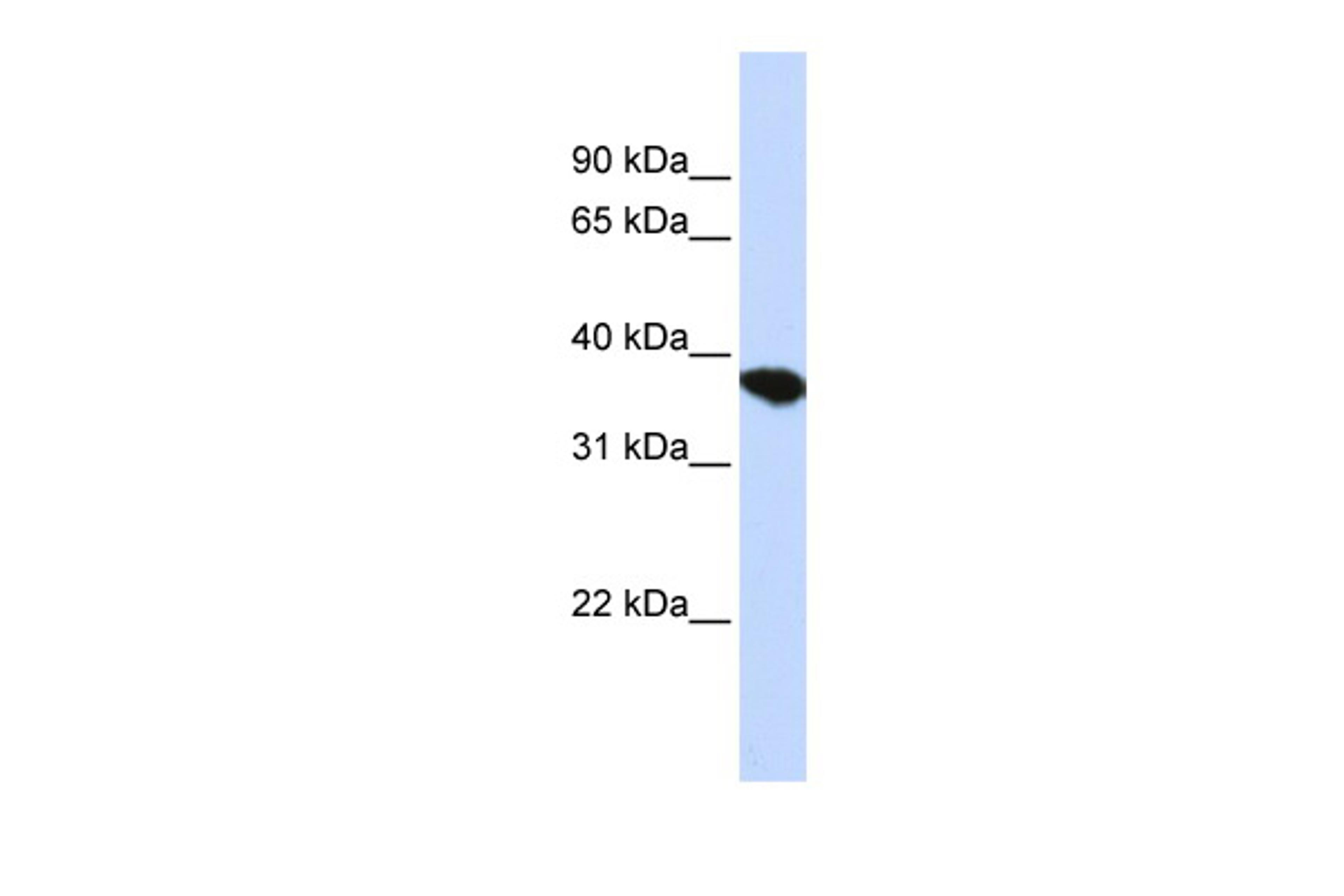 Antibody used in WB on Human HepG2 at 0.2-1 ug/ml.