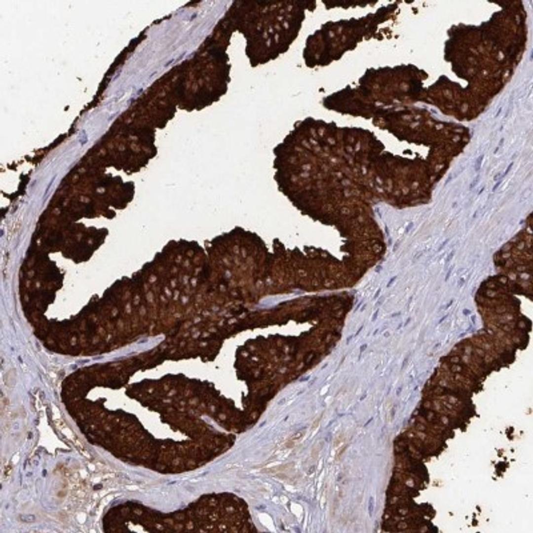 Immunohistochemistry: OR10R2 Antibody [NBP2-32541] - Immunohistochemical staining of human prostate shows strong cytoplasmic positivity in glandular cells.