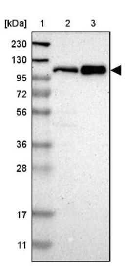 Western Blot: CUL4B Antibody [NBP1-86099] - Lane 1: Marker [kDa] 230, 130, 95, 72, 56, 36, 28, 17, 11<br/>Lane 2: Human cell line RT-4<br/>Lane 3: Human cell line U-251MG sp