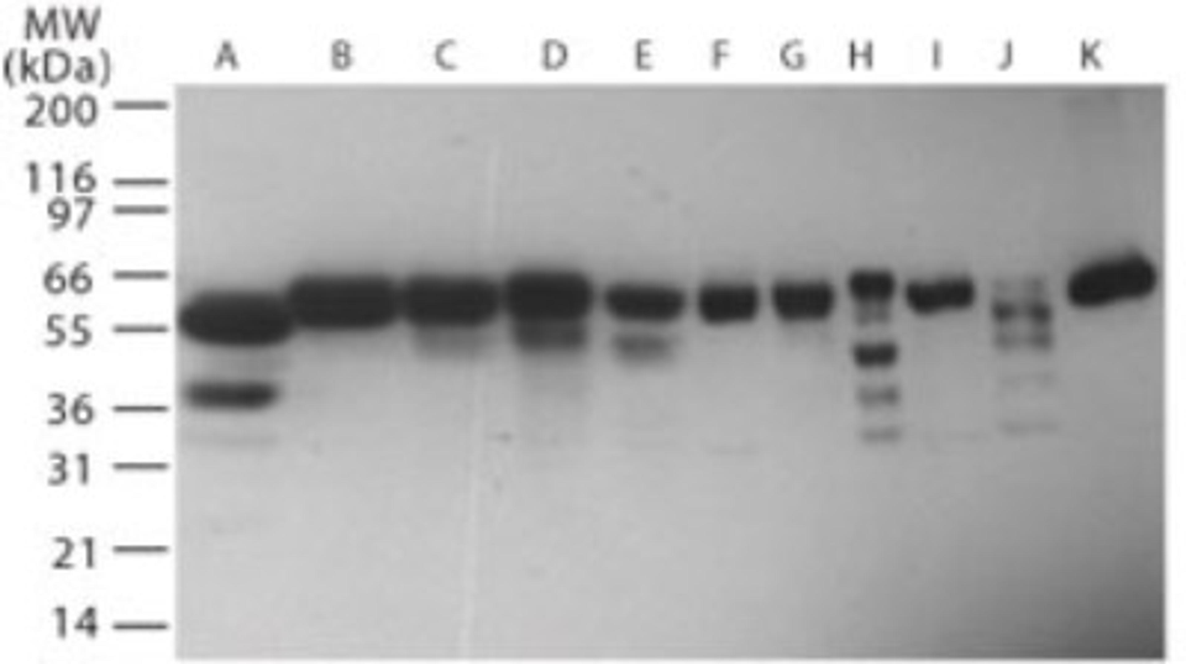 Western Blot: TRIAD3A Antibody [NB100-56891] - Analysis of TRIAD3A in human (A)Brain; (B) Heart; (C) Small Intestine; (D) Kidney; (E) Liver; (F) Lung; (G) Skeletal Muscle; (H) Pancreas; (I) Spleen; (J) Ovary; (K) Testis using NB100-56891 at 1 ug/ml.