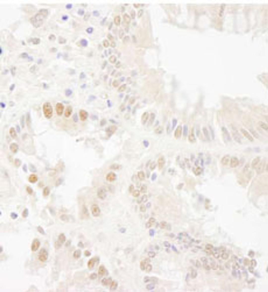 Detection of human Bub1 by immunohistochemistry.