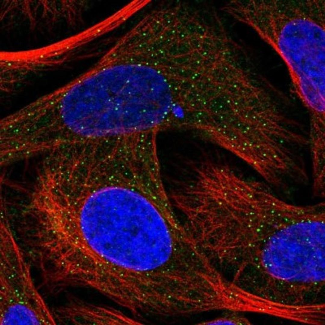 Immunocytochemistry/Immunofluorescence: Neurocan Antibody [NBP1-84368] - Staining of human cell line U-2 OS shows positivity in vesicles & centrosome.