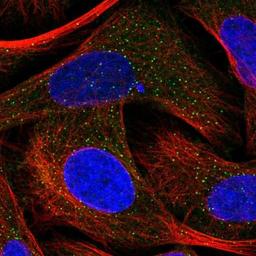 Immunocytochemistry/Immunofluorescence: Neurocan Antibody [NBP1-84368] - Staining of human cell line U-2 OS shows positivity in vesicles & centrosome.