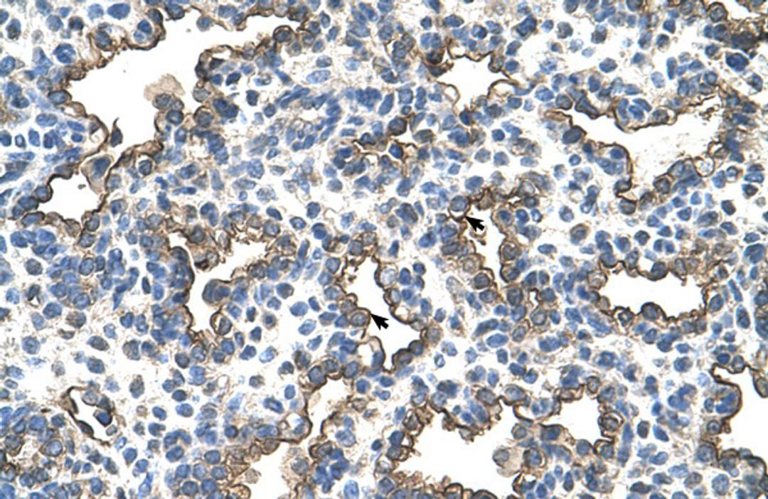 Antibody used in IHC on Human Lung.