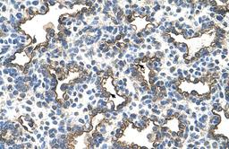 Antibody used in IHC on Human Lung.