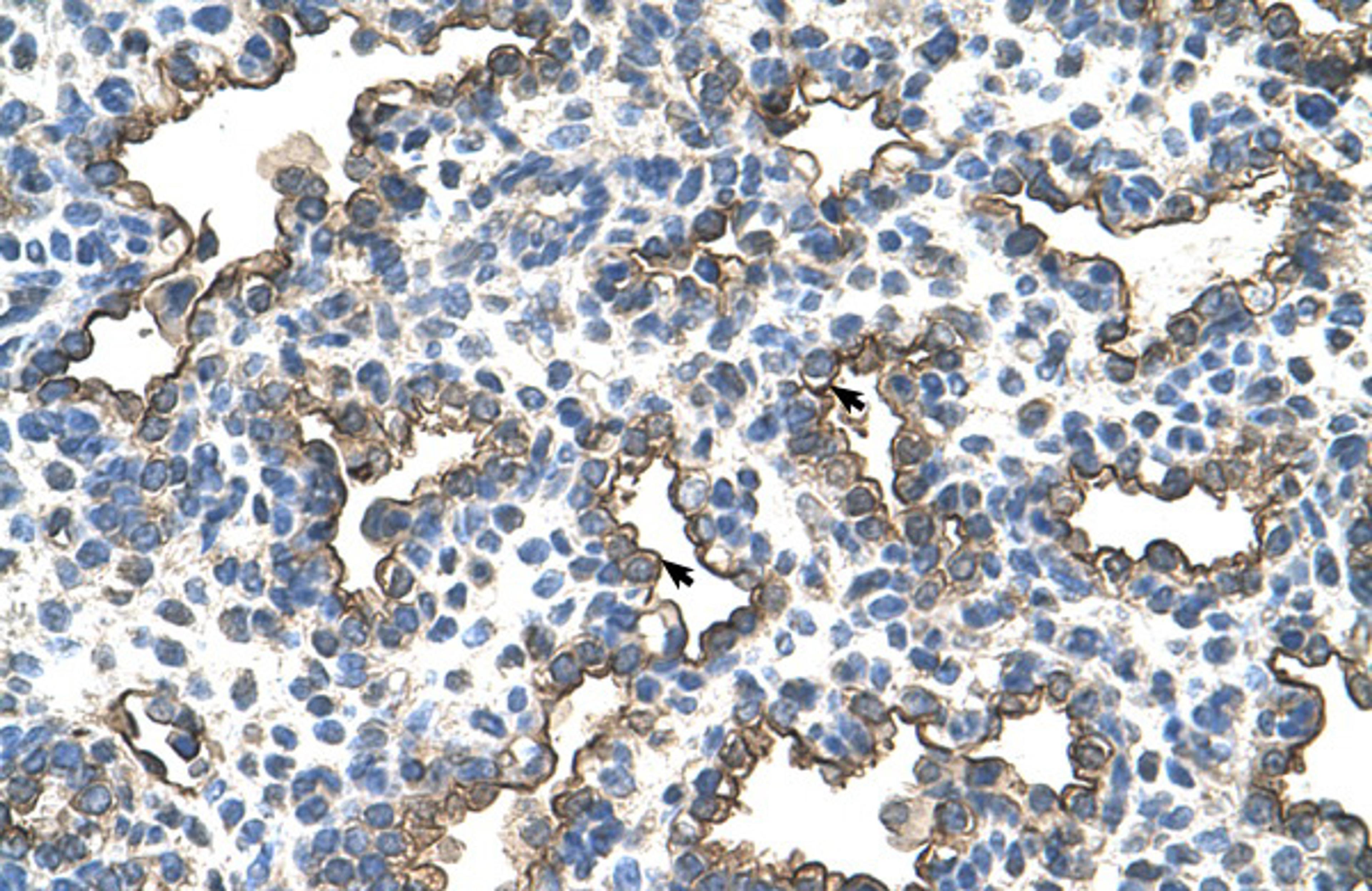 Antibody used in IHC on Human Lung.