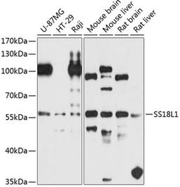 Western blot - SS18L1 antibody (A8822)