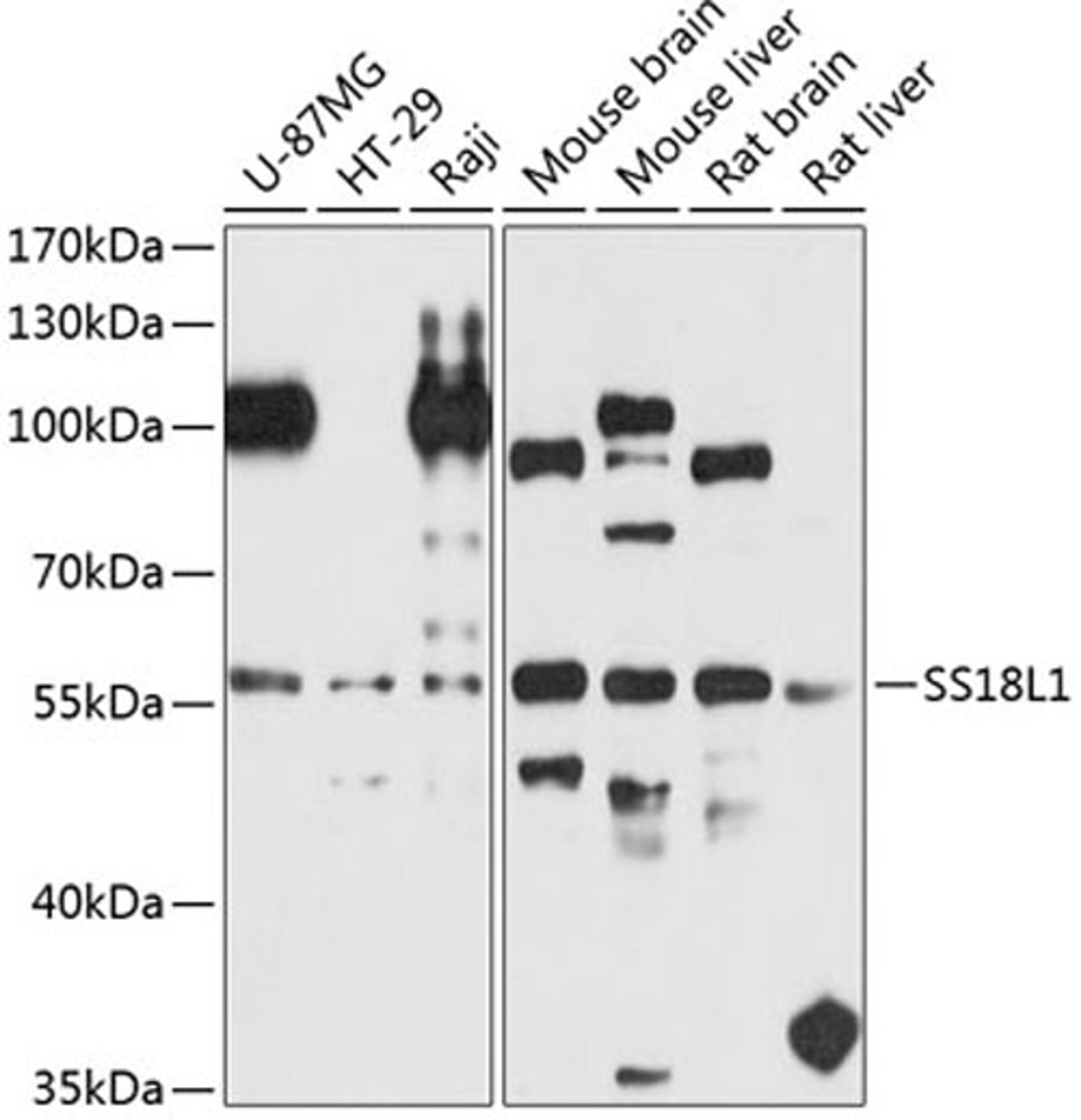 Western blot - SS18L1 antibody (A8822)