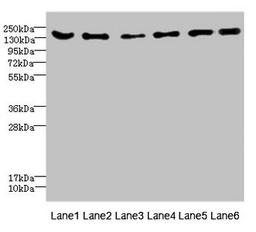 Western blot. All lanes: CD1C antibody at 4.61ug/ml. Lane 1: Mouse brain tissue. Lane 2: Mouse lung tissue. Lane 3: 293T whole cell lysate. Lane 4: HepG2 whole cell lysate. Lane 5: Jurkat whole cell lysate. Lane 6: Hela whole cell lysate. Secondary. Goat polyclonal to rabbit IgG at 1/10000 dilution. Predicted band size: 137, 134, 140 kDa. Observed band size: 137 kDa.