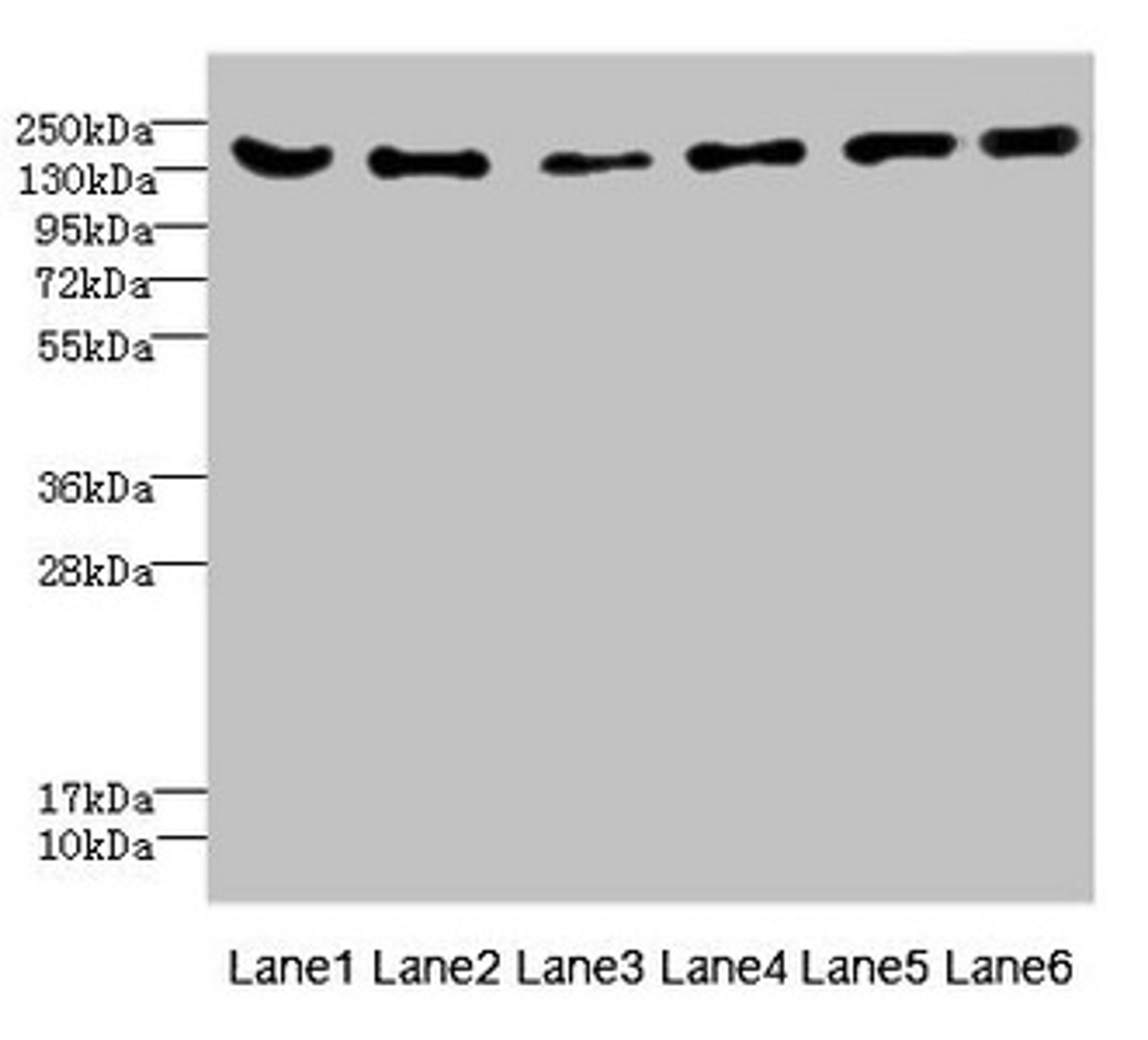Western blot. All lanes: CD1C antibody at 4.61ug/ml. Lane 1: Mouse brain tissue. Lane 2: Mouse lung tissue. Lane 3: 293T whole cell lysate. Lane 4: HepG2 whole cell lysate. Lane 5: Jurkat whole cell lysate. Lane 6: Hela whole cell lysate. Secondary. Goat polyclonal to rabbit IgG at 1/10000 dilution. Predicted band size: 137, 134, 140 kDa. Observed band size: 137 kDa.