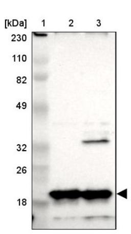 Western Blot: NDUFB8 Antibody [NBP1-88859] - Lane 1: Marker [kDa] 230, 110, 82, 49, 32, 26, 18<br/>Lane 2: Human cell line RT-4<br/>Lane 3: Human cell line U-251MG sp