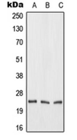 Western blot analysis of HeLa (Lane 1), mouse liver (Lane 2), rat liver (Lane 3) whole cell lysates using FGF19 antibody