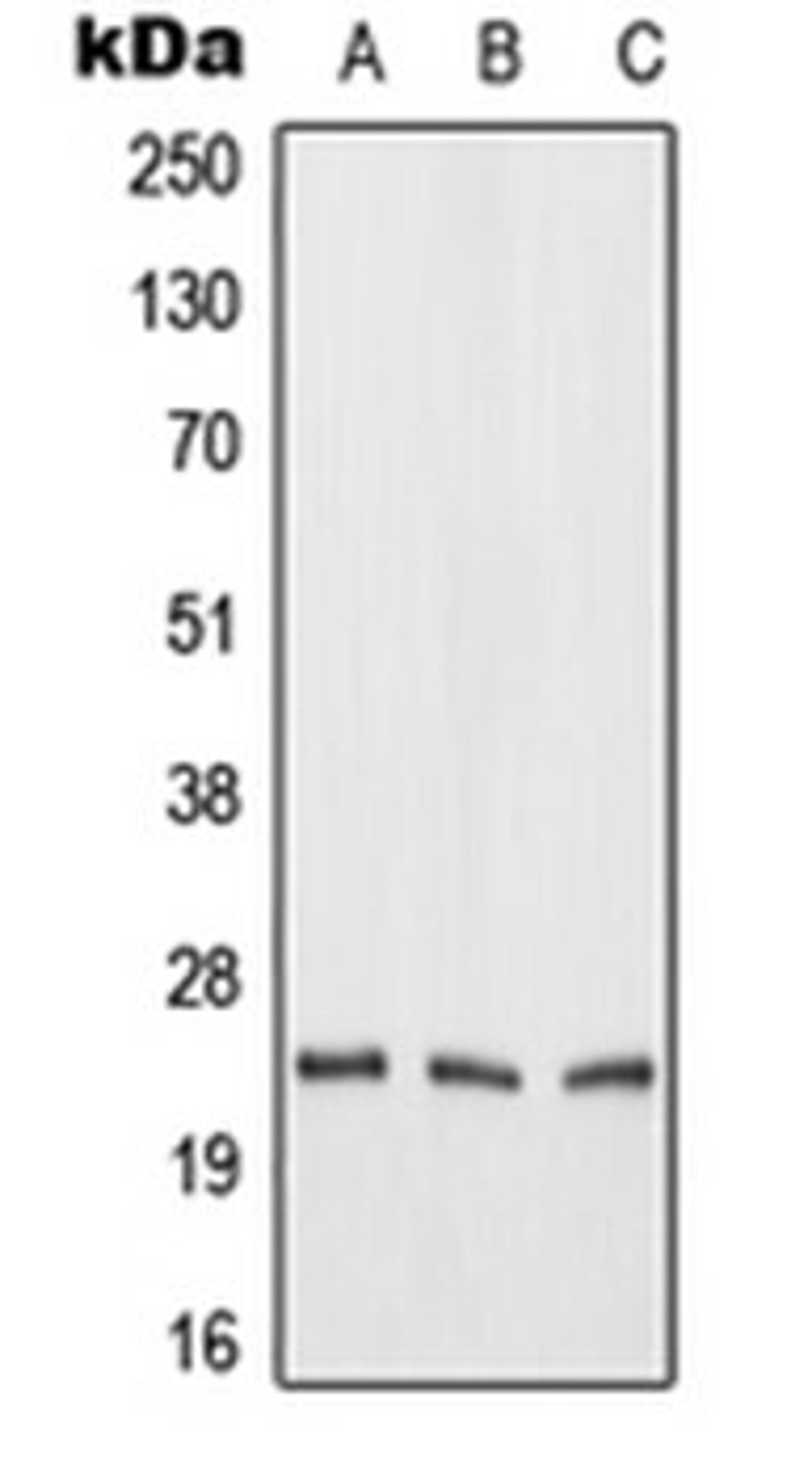 Western blot analysis of HeLa (Lane 1), mouse liver (Lane 2), rat liver (Lane 3) whole cell lysates using FGF19 antibody